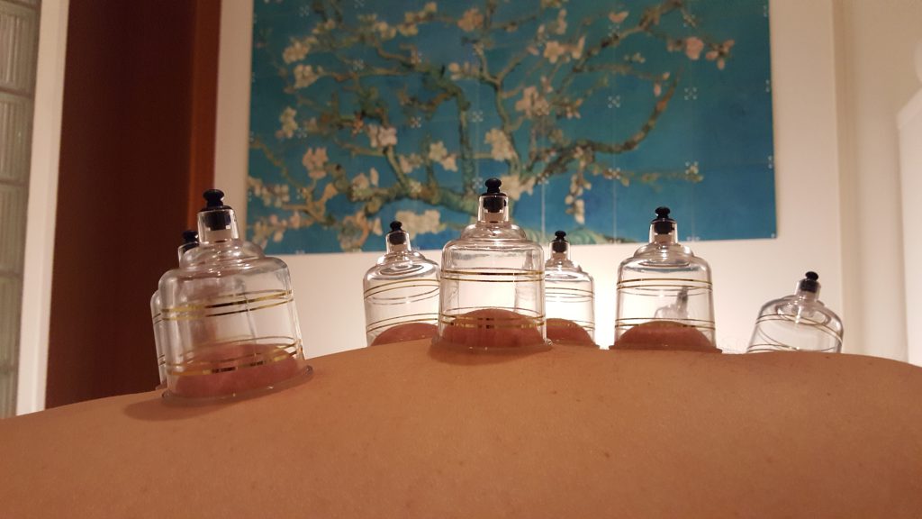 cupping zijkant
